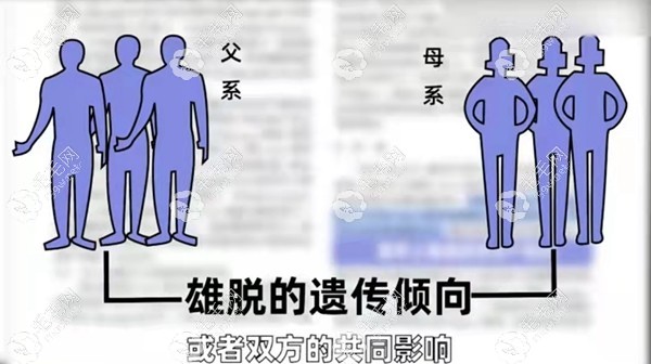 爸妈秃顶是会遗传给男宝宝还是女宝宝呢
