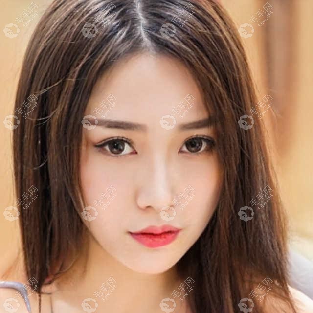 納米微針生發(fā)療法可以代替非那嗎？做了4次防脫治療有話說(shuō)