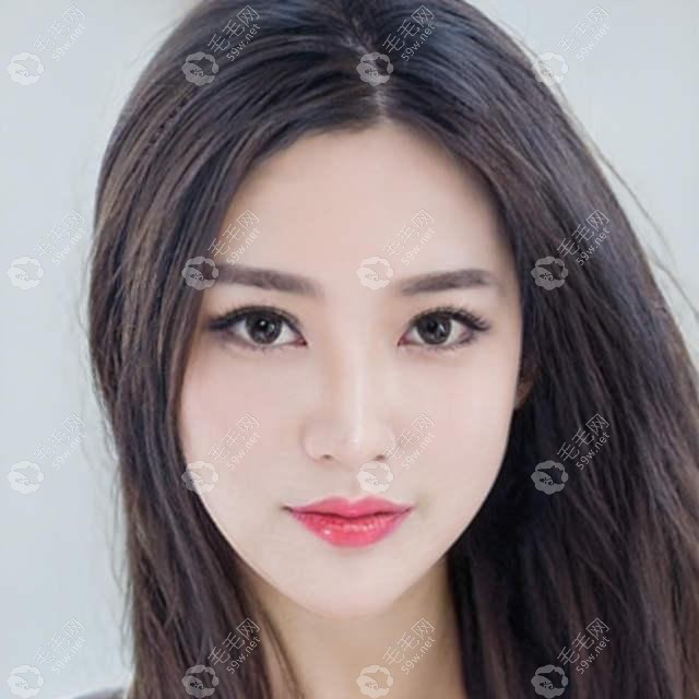 父母秃顶会遗传给下一代女儿或儿子吗又或者会隔代遗传吗?