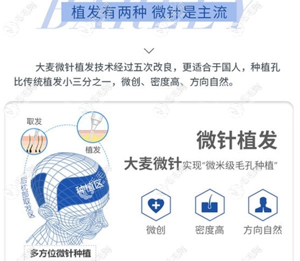 大麦微针植发技术