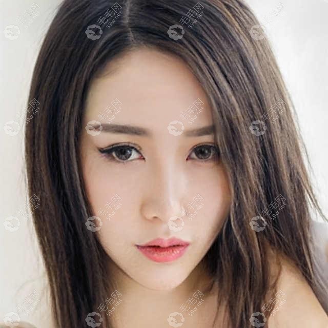 黑龙江哈尔滨瑞丽美利丝植发医院怎么样靠谱吗?咋样往这看