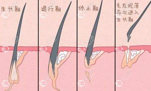 植胡后不管不刮也没问题，它会自己掉哒