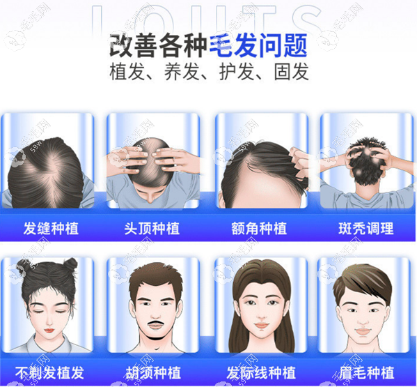 呼和浩特碧莲盛植发医生