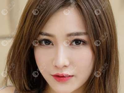 永生植发是真的吗?医院简介和案例给你一看便知