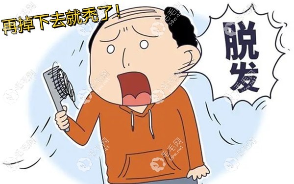 熬夜脱发早睡可以恢复吗