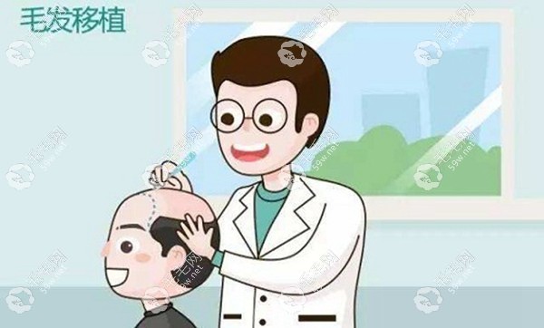 毛發(fā)移植59w.net