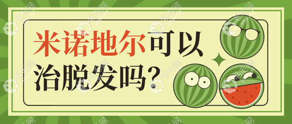 米诺地尔可以治疗脱发吗