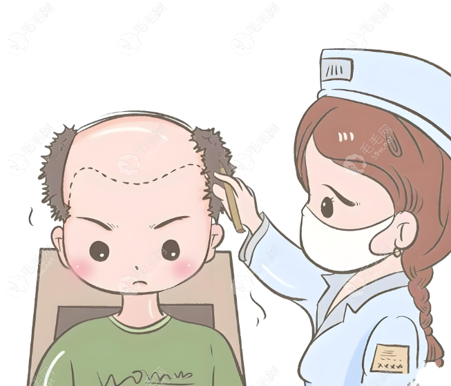 南宁发之友植发实例分享:正规医院做男士额角植发成功率98%+