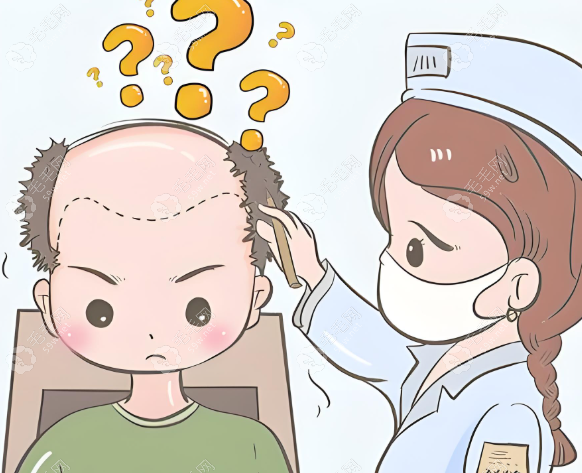 南寧發(fā)之友植發(fā)研究所不坑人