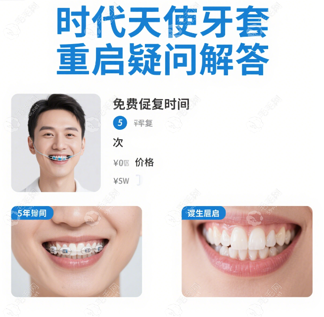 时代天使牙套重启要收费吗