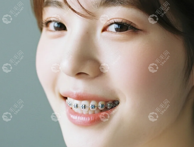 安陽牙齒矯正哪家好