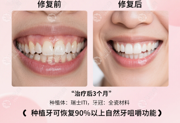 朝陽(yáng)牙博仕口腔收費(fèi)和就診流程一覽,種牙拔牙補(bǔ)牙洗牙不慌