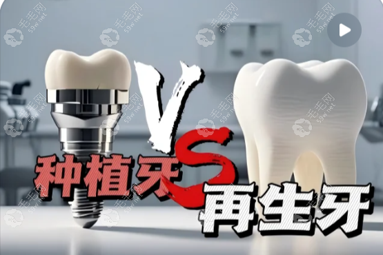 再生牙技術(shù)真的可以代替種牙嗎？再生牙≠種牙