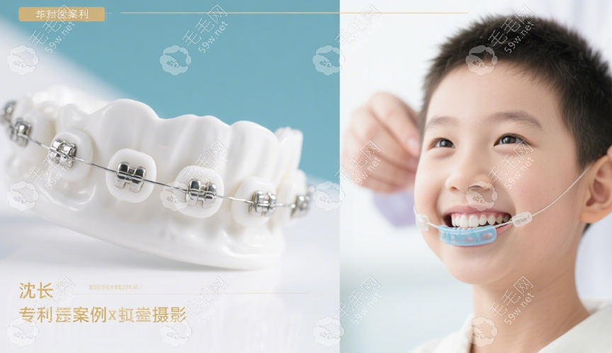 上海沈剛正畸術(shù)后 5 年回訪實錄