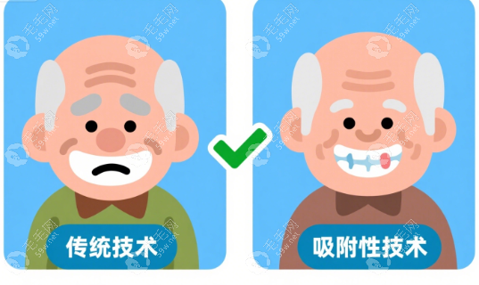 長(zhǎng)春吸附性義齒