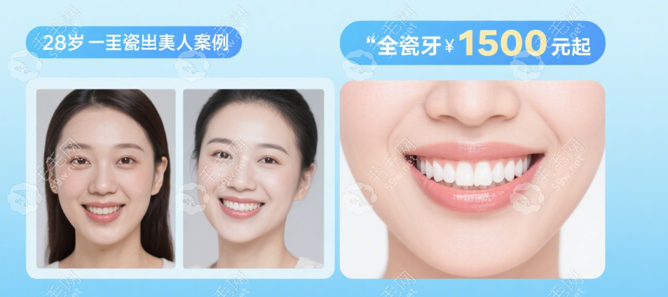 北大口腔醫(yī)院全瓷牙修復(fù)實(shí)例