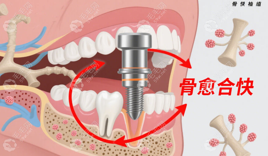 骨愈合快