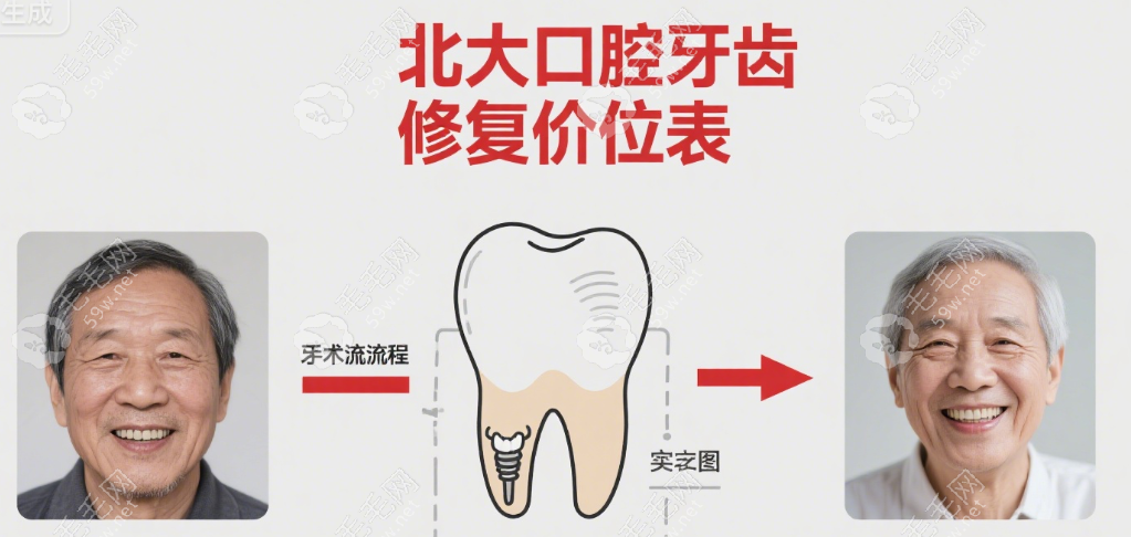 北大口腔牙齒修復(fù)價(jià)位表2025