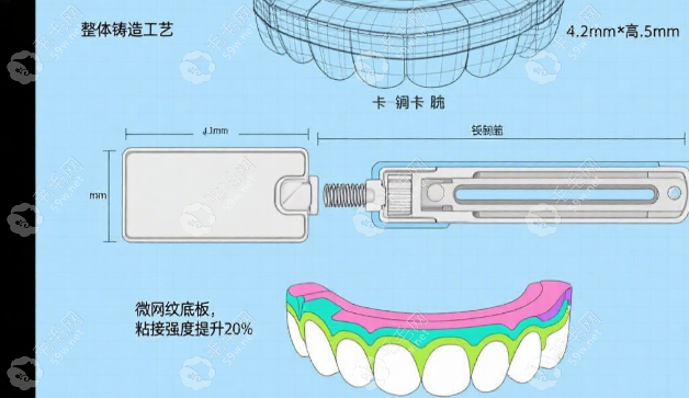 普特自鎖托槽質(zhì)量怎么樣
