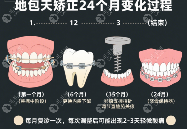 如何將地包天手術(shù)風(fēng)險(xiǎn)降到低