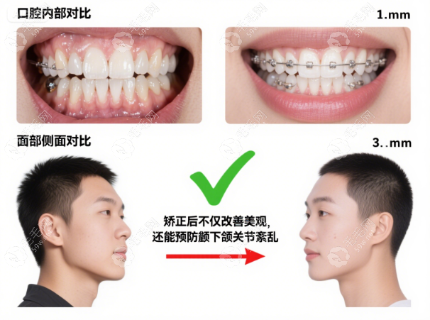 地包天牙齒手術(shù)風(fēng)險(xiǎn)大嗎