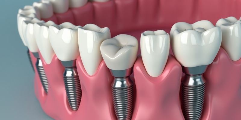 桀诺种植牙和奥齿泰区别大吗？牙科医生揭秘两者适应症/使用寿命/材质差异