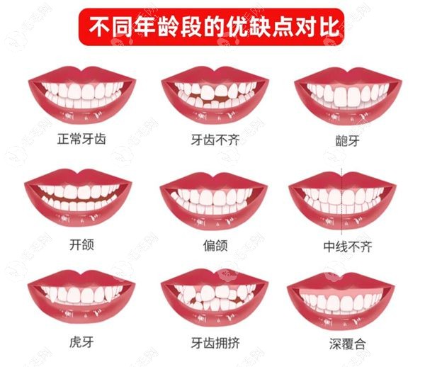 储艳蓉医生擅长牙齿矫正