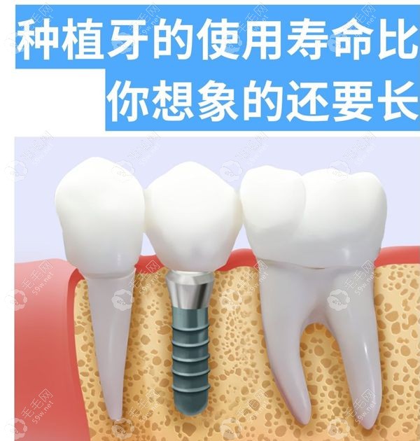 重庆南川区爱牙世家口腔诊所擅长种植牙
