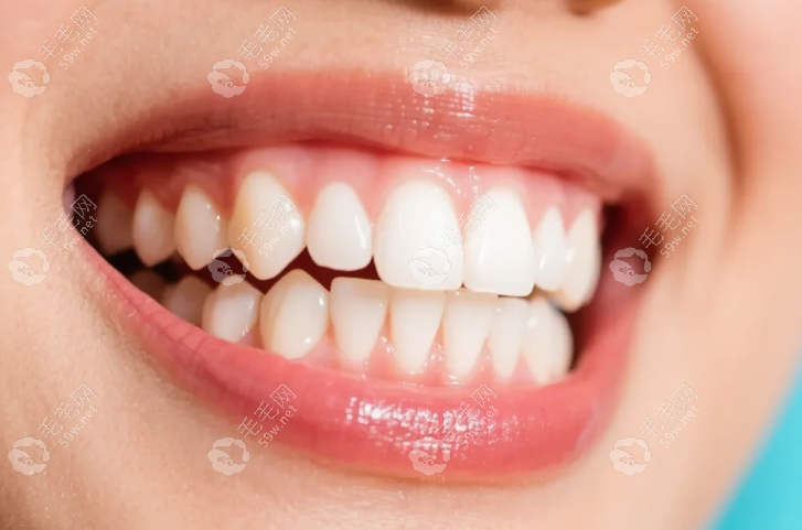 義烏義惠口腔哪位醫(yī)生好點(diǎn)
