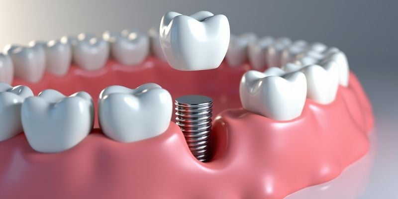 二、西安双宝口腔牙齿美白技术解析