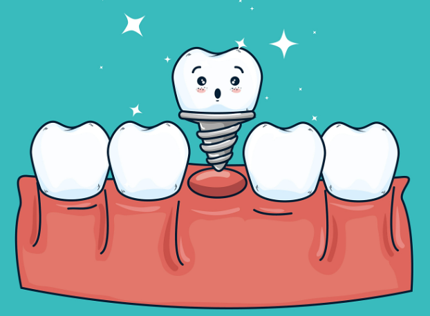 沈阳德立联合口腔种植牙患者实例
