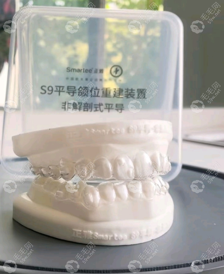 模型