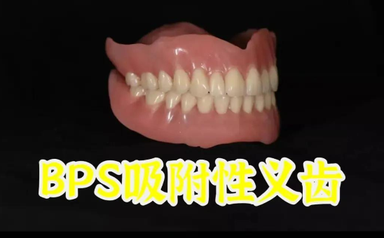哈尔滨bps吸附性义齿价格：常规品牌6000元，知名品牌9500元起
