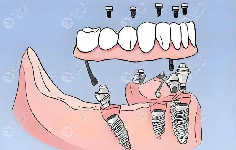 20251030563876.png image.png