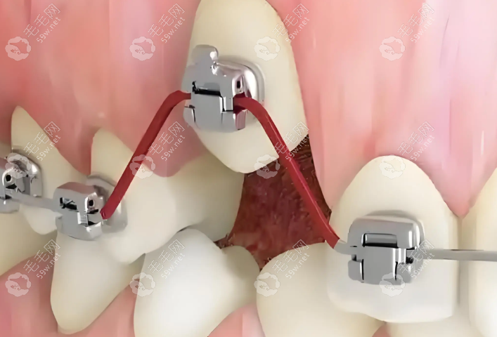 福清美特尔口腔价格透明 福清美特尔口腔价格透明