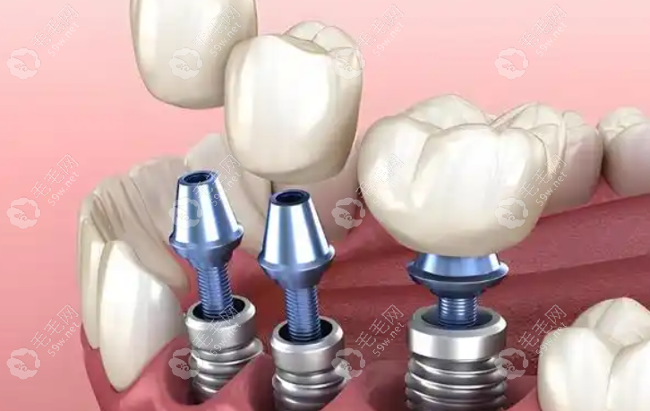 20251030770076.png image.png