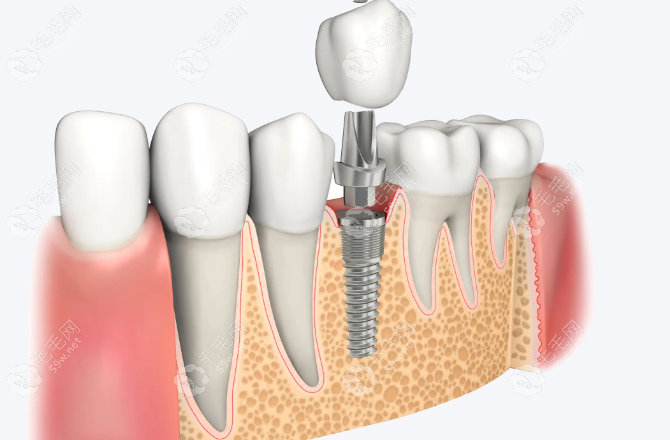 20251030885166.png image.png