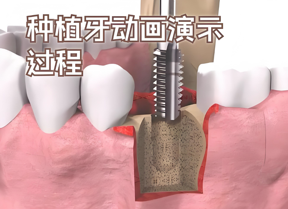 杭州中德口腔怎么样