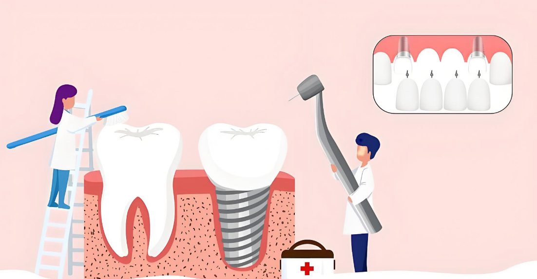 杭州植成口腔种植牙怎么样www.59w.net