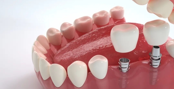 五棵松劲松口腔医院价格