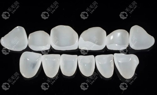 白牙吖全瓷牙