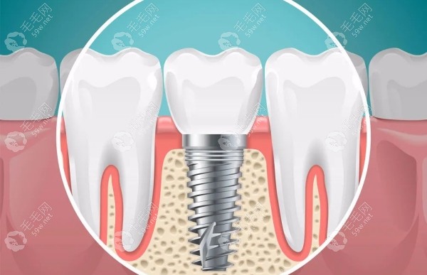 青岛华颐口腔能看哪些牙病