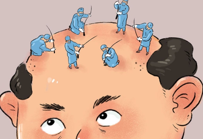 北京雍禾植发性价比