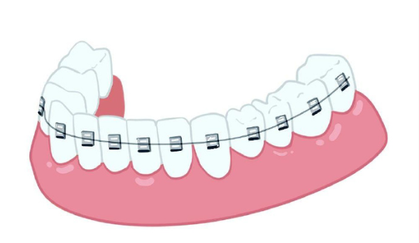 辽阳维尔口腔牙做的好不?特色项目:疗效显著