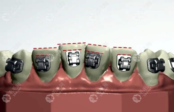 唐俊男医生矫正服务的适配人群 唐俊男医生矫正服务的适配人群