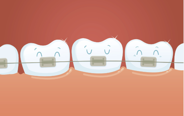 安顺牙博仕口腔正畸的优势