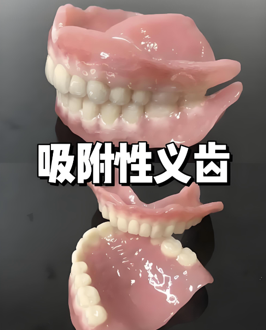 宁波吸附性义齿医院如何选