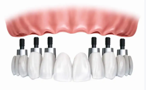 贵阳德韩口腔花果园院区的特色项目