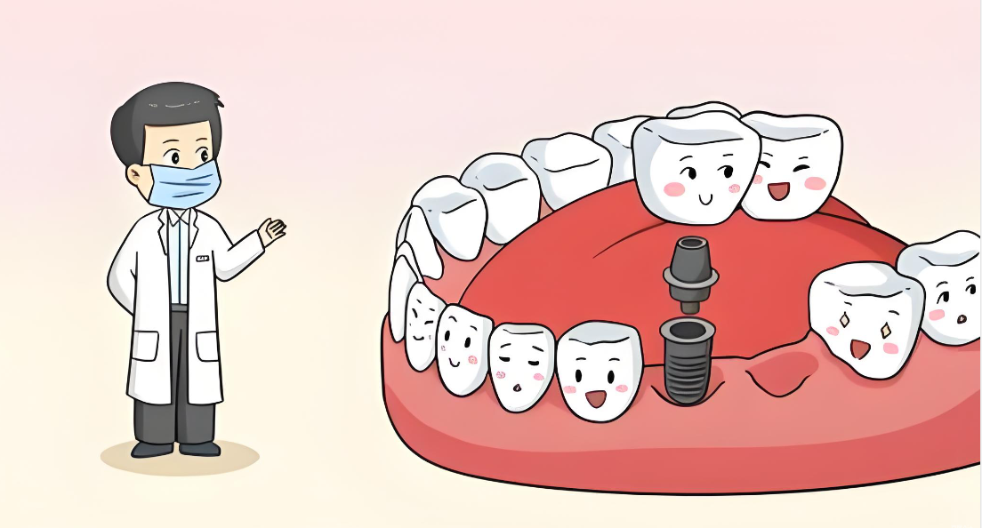 温州种植牙医院如何选www.59w.net