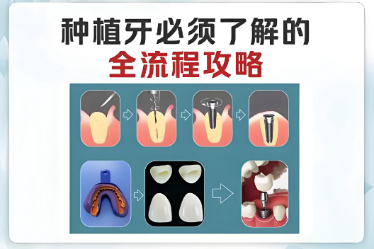 以色列雅定种植牙怎么样好不好www.59w.net